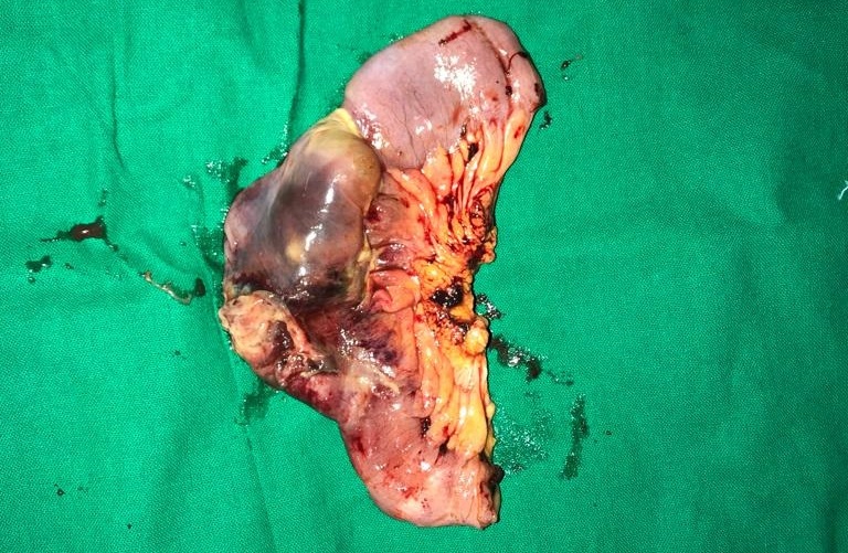 Gastroenterologist in Nashik