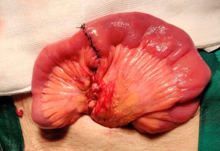 Gastroenterologist in Nashik